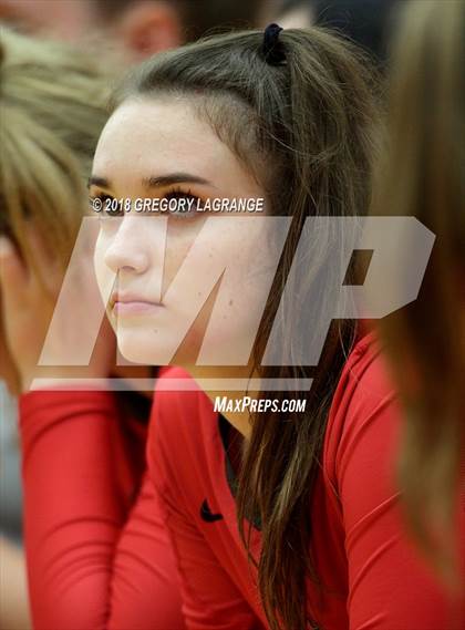 Thumbnail 3 in Wakeland [Justin] vs Liberty photogallery.