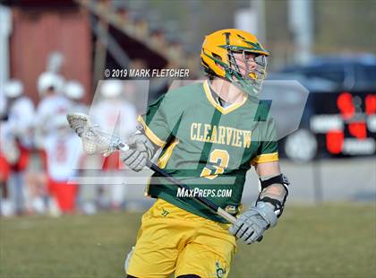 Thumbnail 1 in Clearview @ Lenape photogallery.