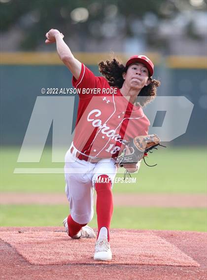 Thumbnail 1 in Alemany vs. Corona photogallery.
