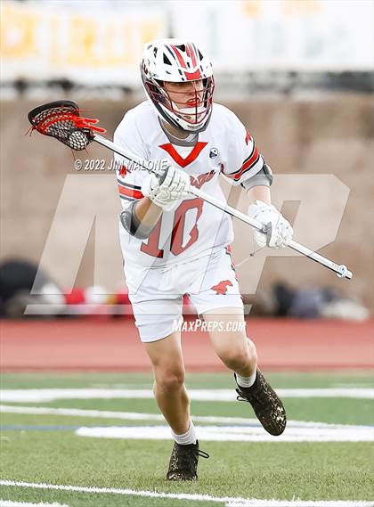 Thumbnail 2 in Jesuit @ Monte Vista (CIFNCS D1 First Rd) photogallery.