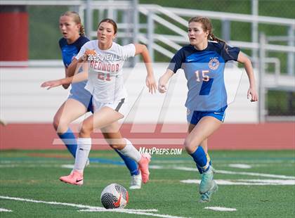 Thumbnail 1 in Redwood @ Tamalpais (MCAL Championship) photogallery.