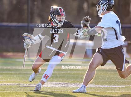 Thumbnail 2 in Hilton @ Pittsford photogallery.