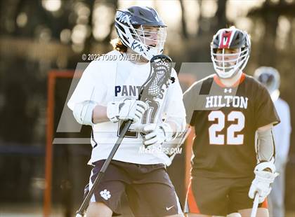 Thumbnail 1 in Hilton @ Pittsford photogallery.