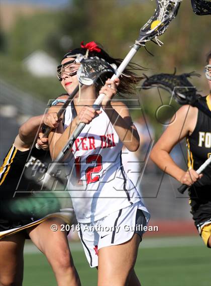 Thumbnail 1 in Foothill vs. Mater Dei (Orange County Championship Final) photogallery.
