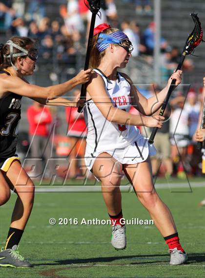 Thumbnail 3 in Foothill vs. Mater Dei (Orange County Championship Final) photogallery.