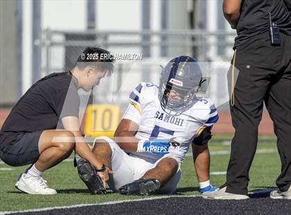 Thumbnail 1 in Santa Monica @ Peninsula photogallery.