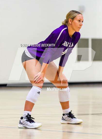 Thumbnail 2 in Anna vs. Tom Bean (Hwy 75 Volleyfest) photogallery.