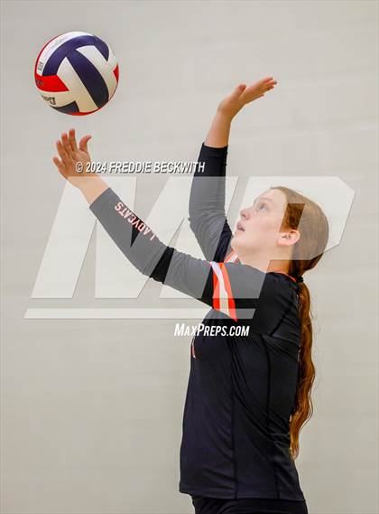 Thumbnail 3 in Anna vs. Tom Bean (Hwy 75 Volleyfest) photogallery.