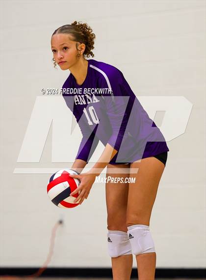 Thumbnail 3 in Anna vs. Tom Bean (Hwy 75 Volleyfest) photogallery.