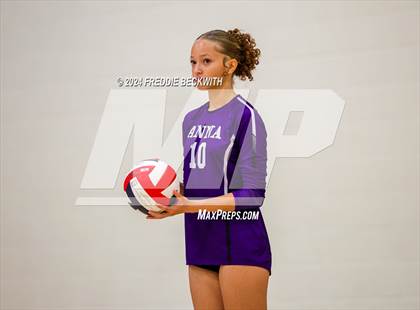 Thumbnail 1 in Anna vs. Tom Bean (Hwy 75 Volleyfest) photogallery.