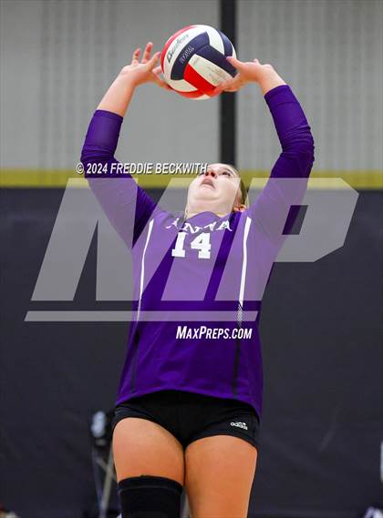 Thumbnail 2 in Anna vs. Tom Bean (Hwy 75 Volleyfest) photogallery.