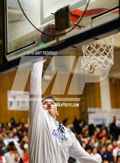 Thumbnail 2 in Campolindo @ Acalanes photogallery.