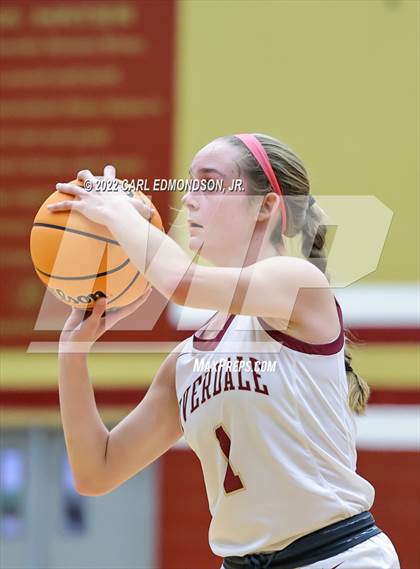 Thumbnail 2 in Kenwood @ Riverdale photogallery.