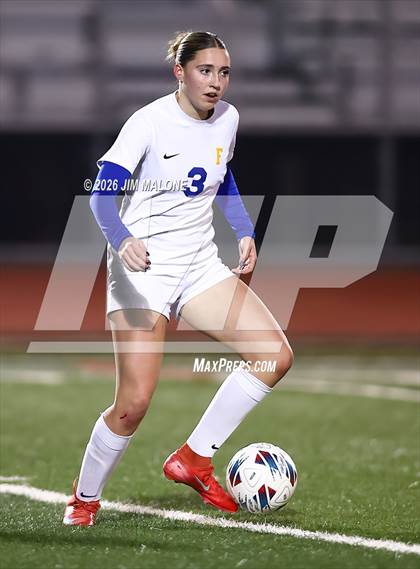 Thumbnail 1 in Foothill @ Granada photogallery.