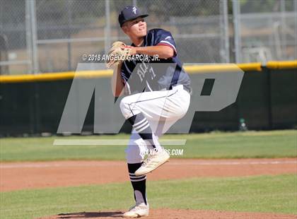 Thumbnail 2 in Freedom vs Deer Valley photogallery.