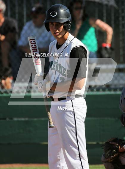 Thumbnail 3 in Freedom vs Deer Valley photogallery.