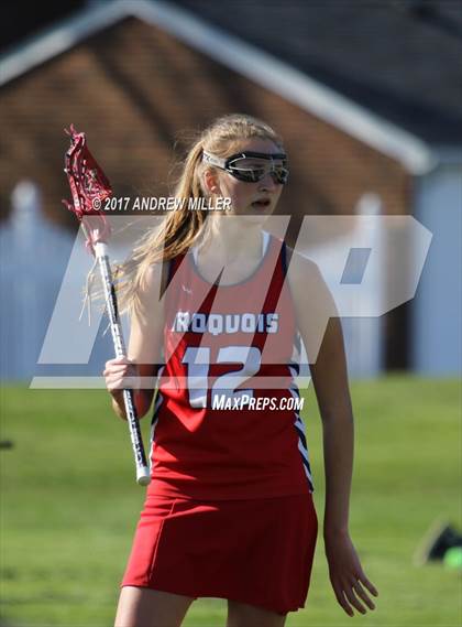 Thumbnail 1 in Iroquois @ Williamsville East photogallery.
