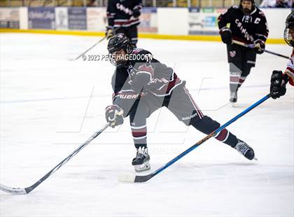 Thumbnail 3 in Morristown-Beard @ Mount Olive photogallery.