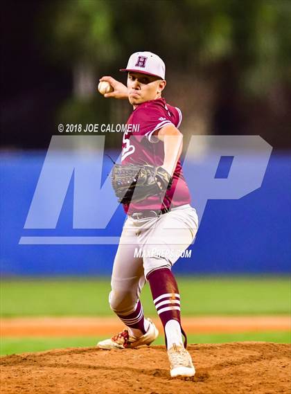 Thumbnail 1 in Highlands vs Burbank photogallery.