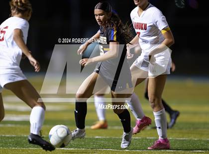 Thumbnail 3 in Kahuku @ Kaiser photogallery.