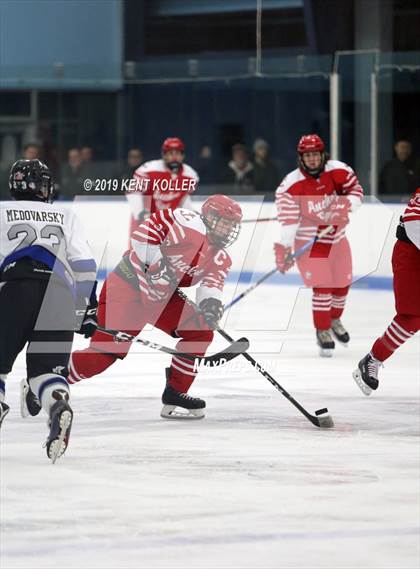 Thumbnail 1 in Anchor Bay @ Utica Eisenhower photogallery.