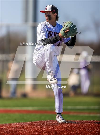 Thumbnail 1 in Melissa vs Wylie (Abilene ISD Tournament) photogallery.