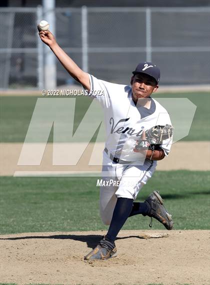 Thumbnail 1 in Palisades vs. Venice photogallery.
