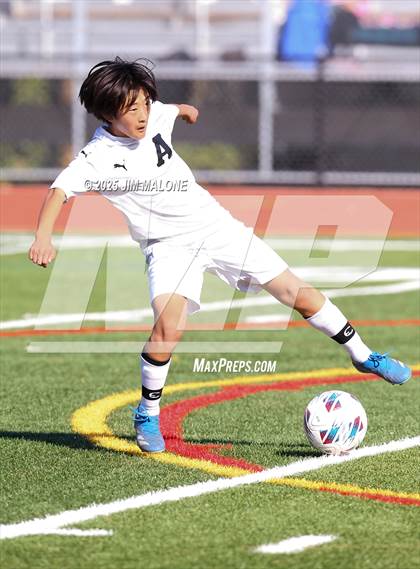Thumbnail 2 in Alameda @ San Ramon Valley photogallery.