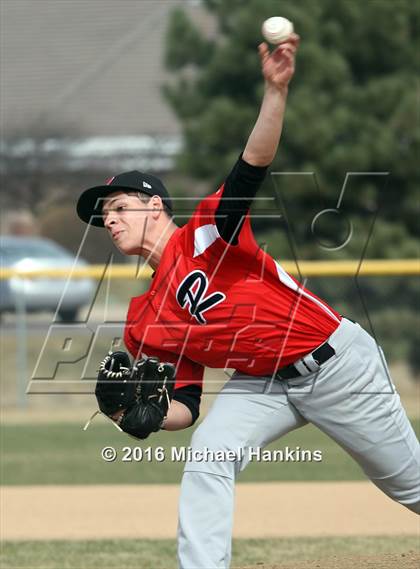 Thumbnail 1 in Rangeview @ ThunderRidge photogallery.
