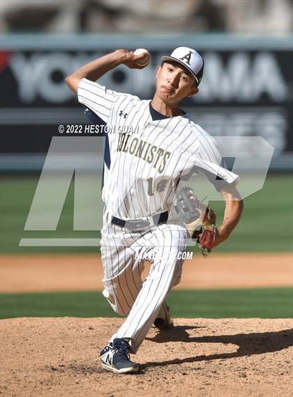Thumbnail 2 in Segerstrom vs. Anaheim photogallery.