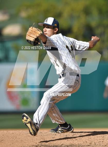 Thumbnail 3 in Segerstrom vs. Anaheim photogallery.