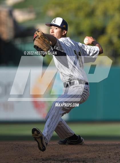 Thumbnail 2 in Segerstrom vs. Anaheim photogallery.
