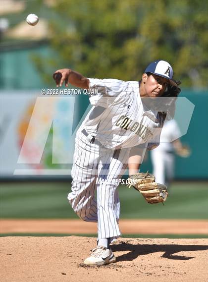 Thumbnail 3 in Segerstrom vs. Anaheim photogallery.