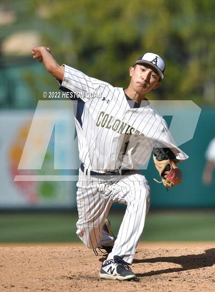 Thumbnail 2 in Segerstrom vs. Anaheim photogallery.