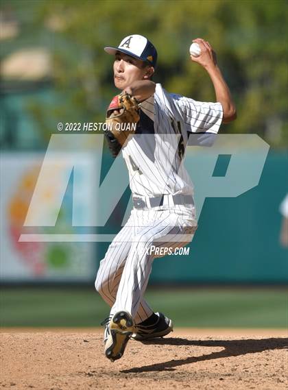 Thumbnail 2 in Segerstrom vs. Anaheim photogallery.