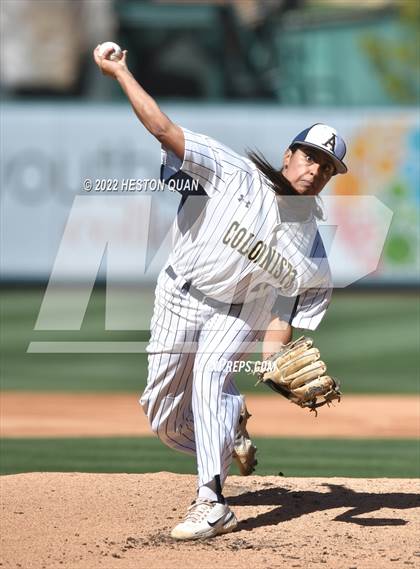 Thumbnail 1 in Segerstrom vs. Anaheim photogallery.