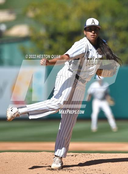Thumbnail 1 in Segerstrom vs. Anaheim photogallery.