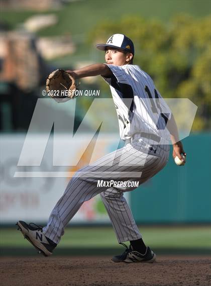 Thumbnail 3 in Segerstrom vs. Anaheim photogallery.