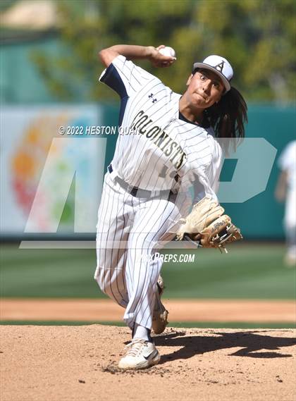 Thumbnail 2 in Segerstrom vs. Anaheim photogallery.