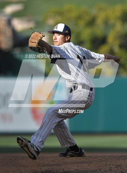 Thumbnail 3 in Segerstrom vs. Anaheim photogallery.