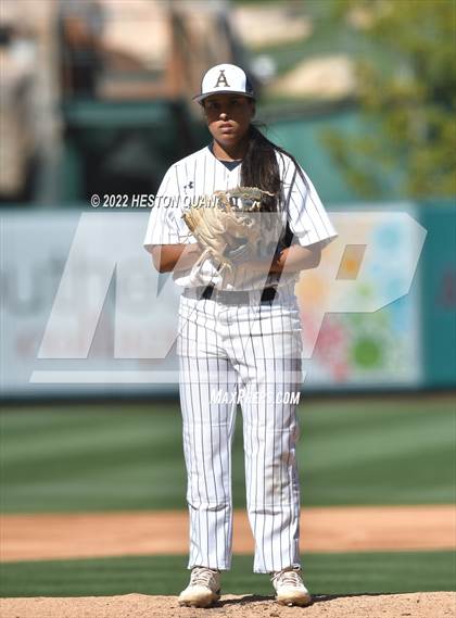 Thumbnail 1 in Segerstrom vs. Anaheim photogallery.
