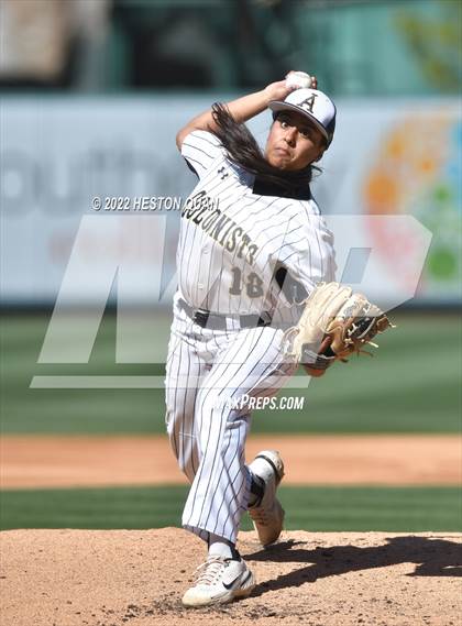 Thumbnail 1 in Segerstrom vs. Anaheim photogallery.