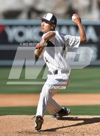 Thumbnail 1 in Segerstrom vs. Anaheim photogallery.