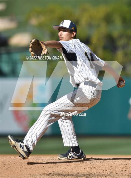 Thumbnail 3 in Segerstrom vs. Anaheim photogallery.