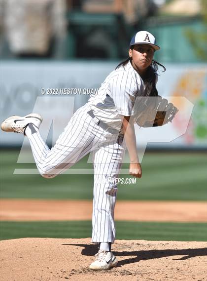 Thumbnail 2 in Segerstrom vs. Anaheim photogallery.