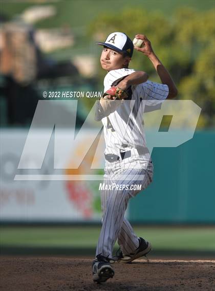Thumbnail 1 in Segerstrom vs. Anaheim photogallery.