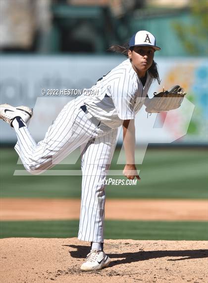 Thumbnail 1 in Segerstrom vs. Anaheim photogallery.