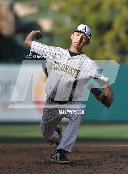 Thumbnail 2 in Segerstrom vs. Anaheim photogallery.