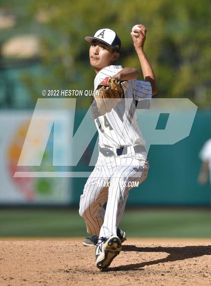 Thumbnail 2 in Segerstrom vs. Anaheim photogallery.