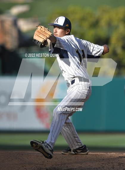 Thumbnail 3 in Segerstrom vs. Anaheim photogallery.